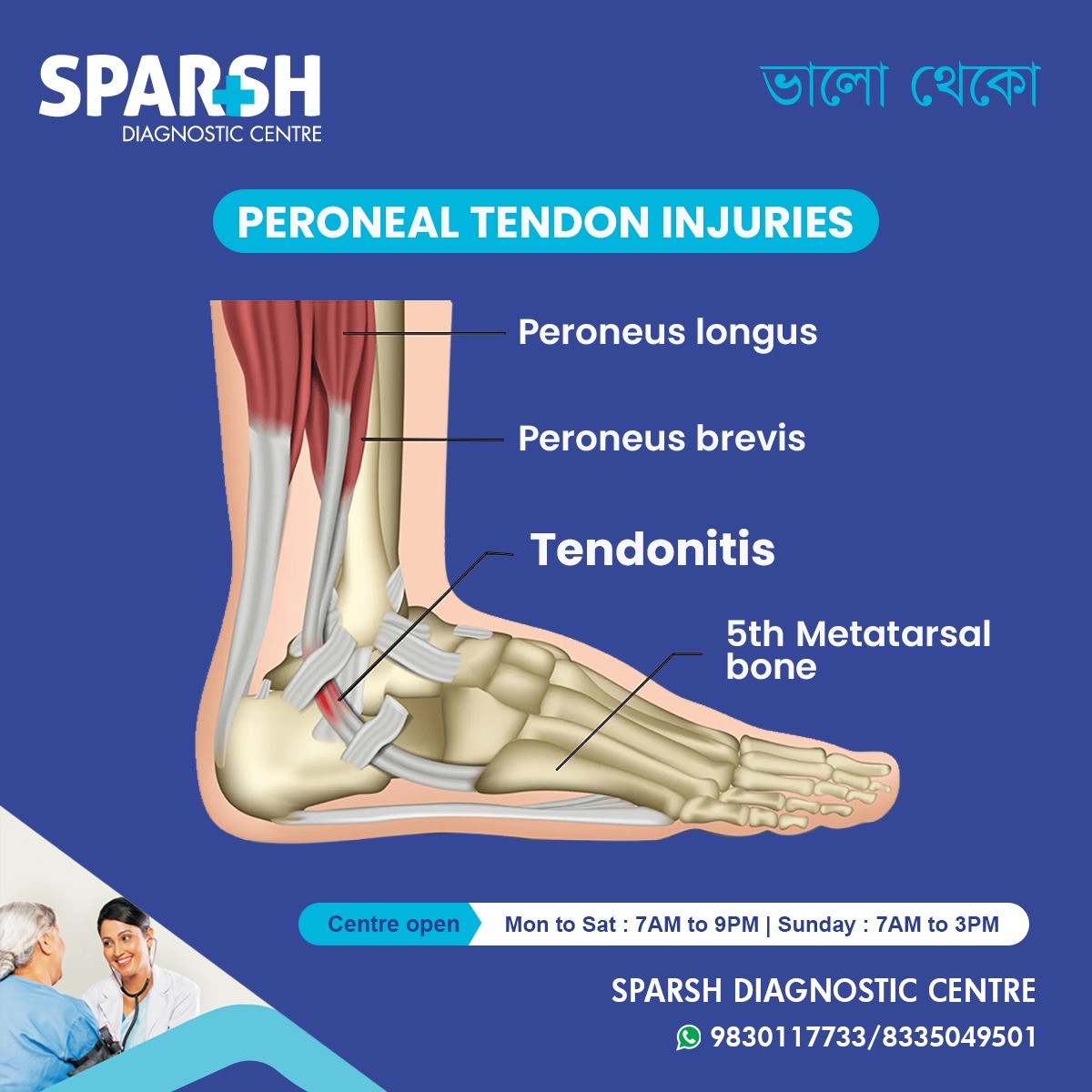 Peroneal Tendon Injuries
