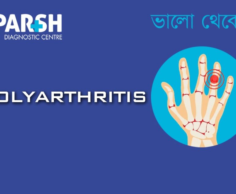 Polyarthritis CP