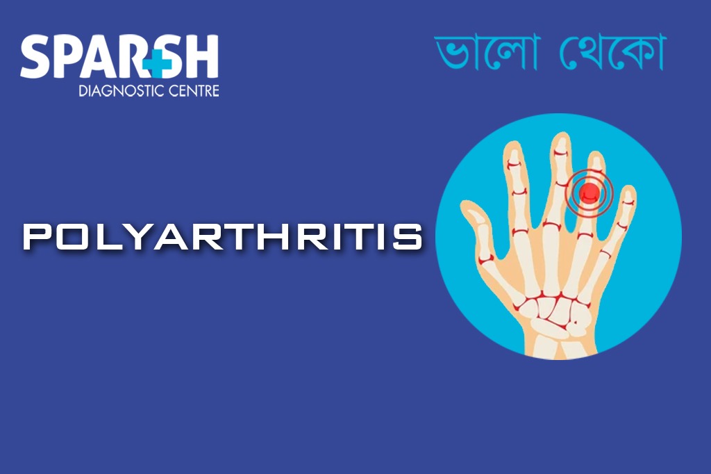 Polyarthritis CP