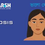 Ptosis