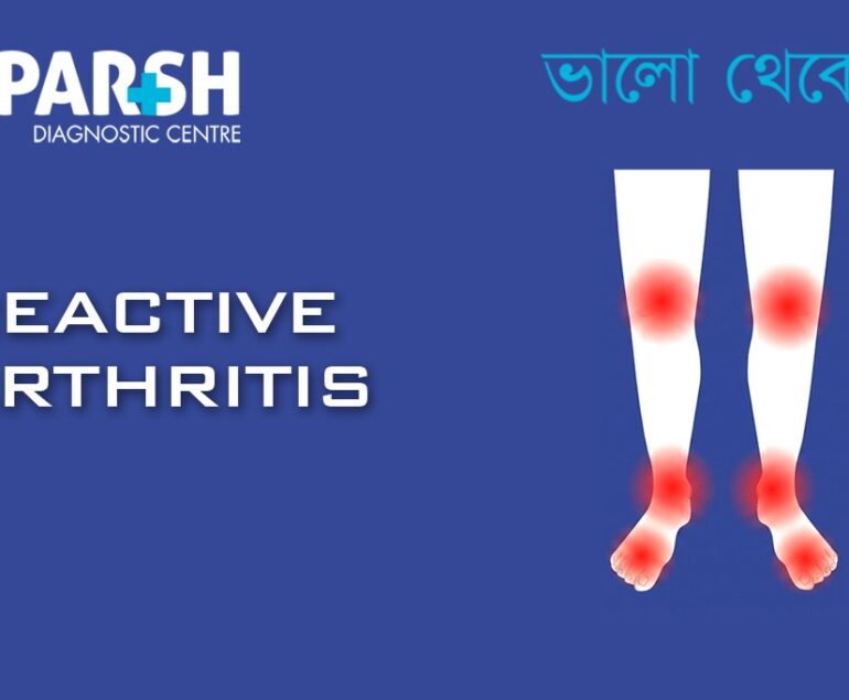 Reactive Arthritis