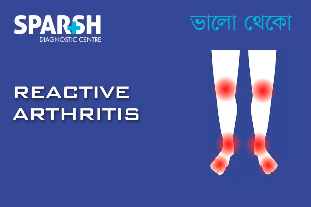 Reactive Arthritis