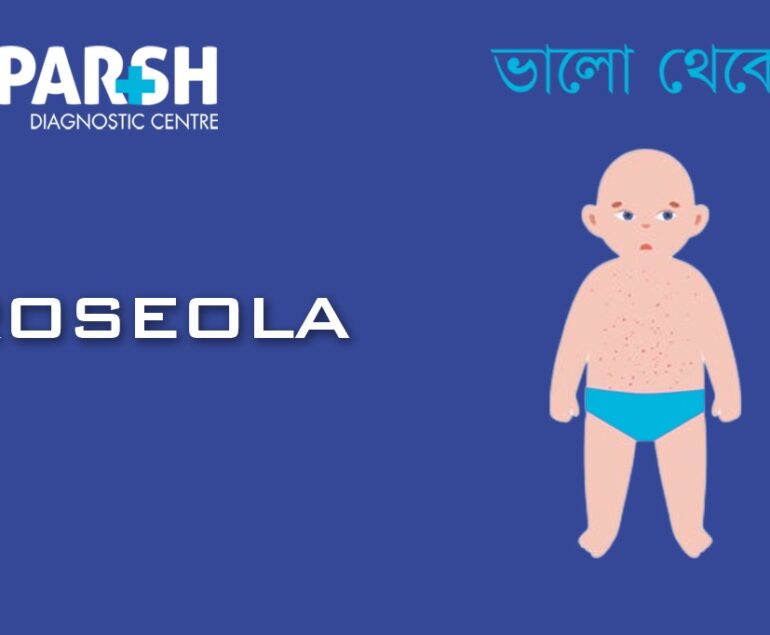 Roseola