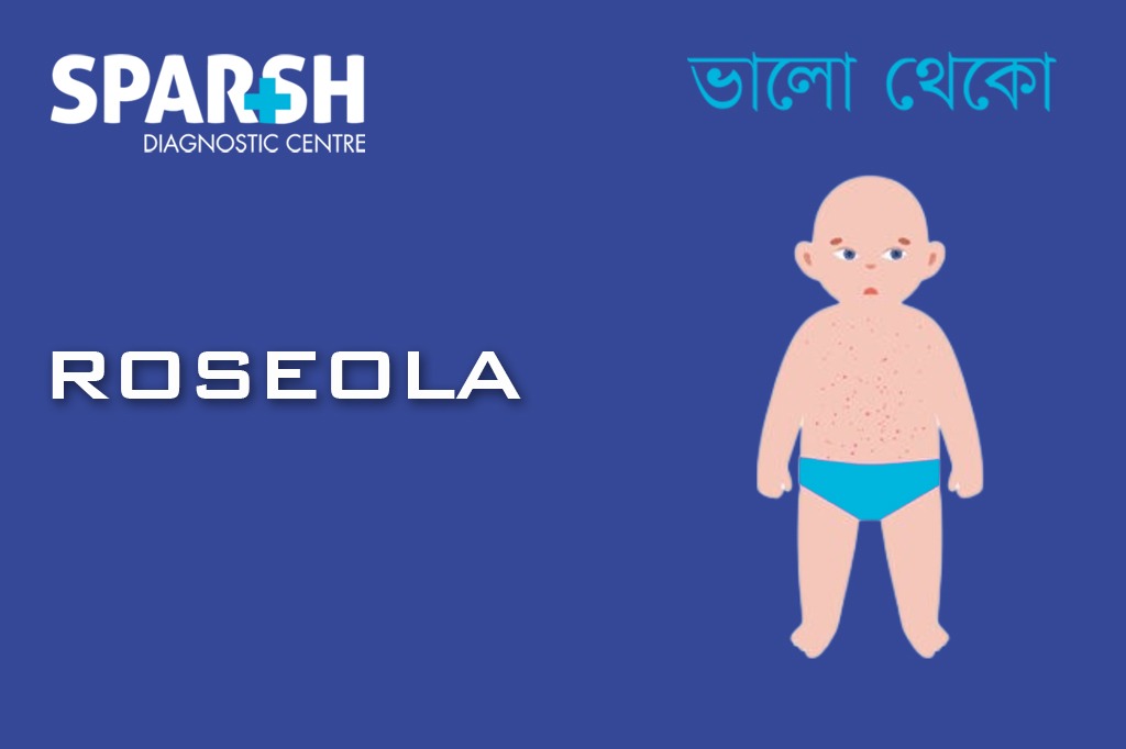 Roseola