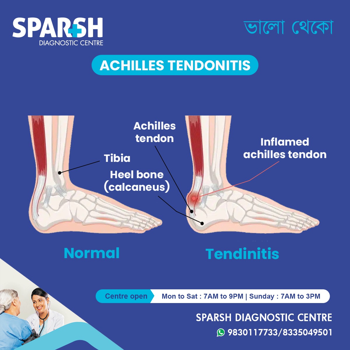 What Is Achilles Tendonitis