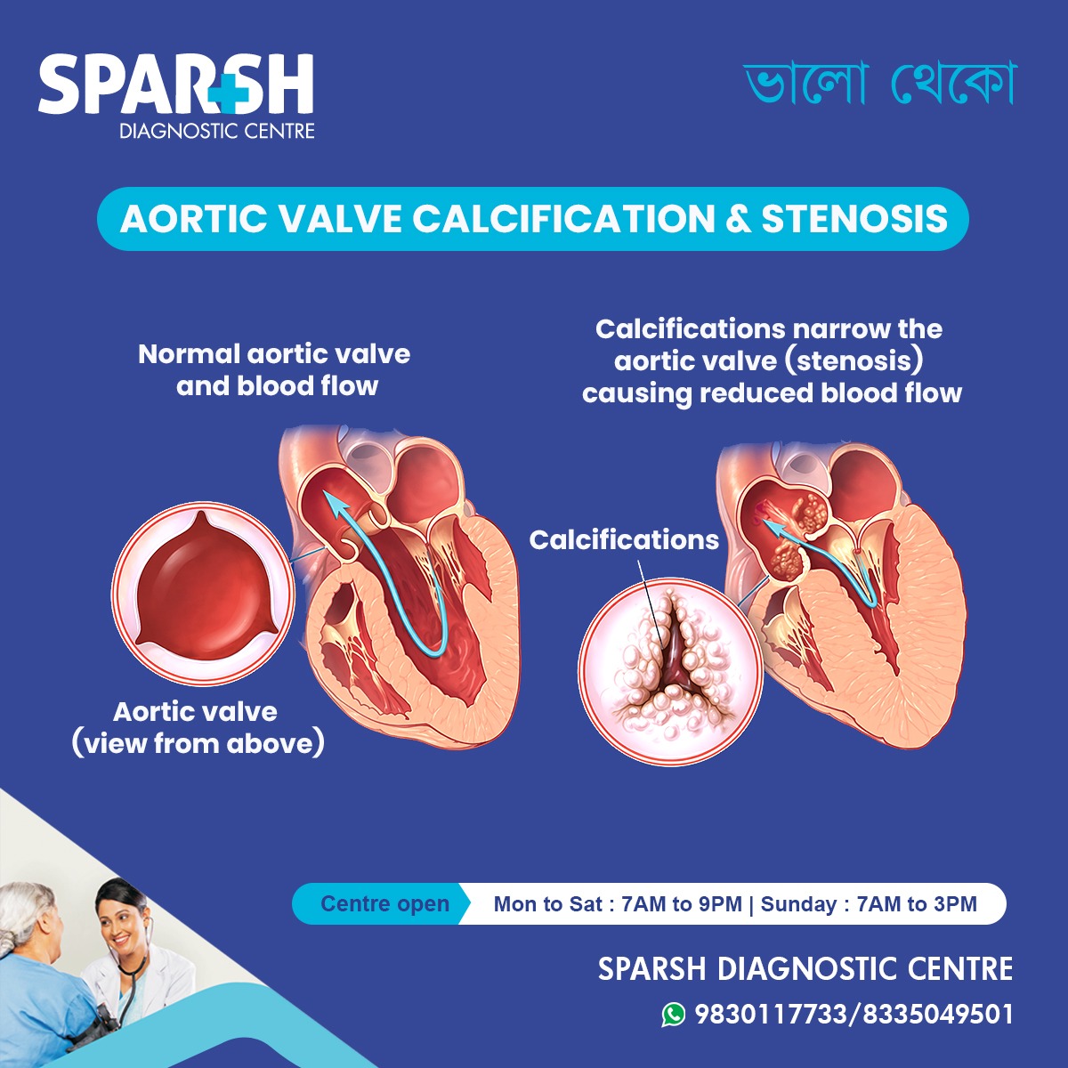 What Is Aortic Valve Calcification Stenosis