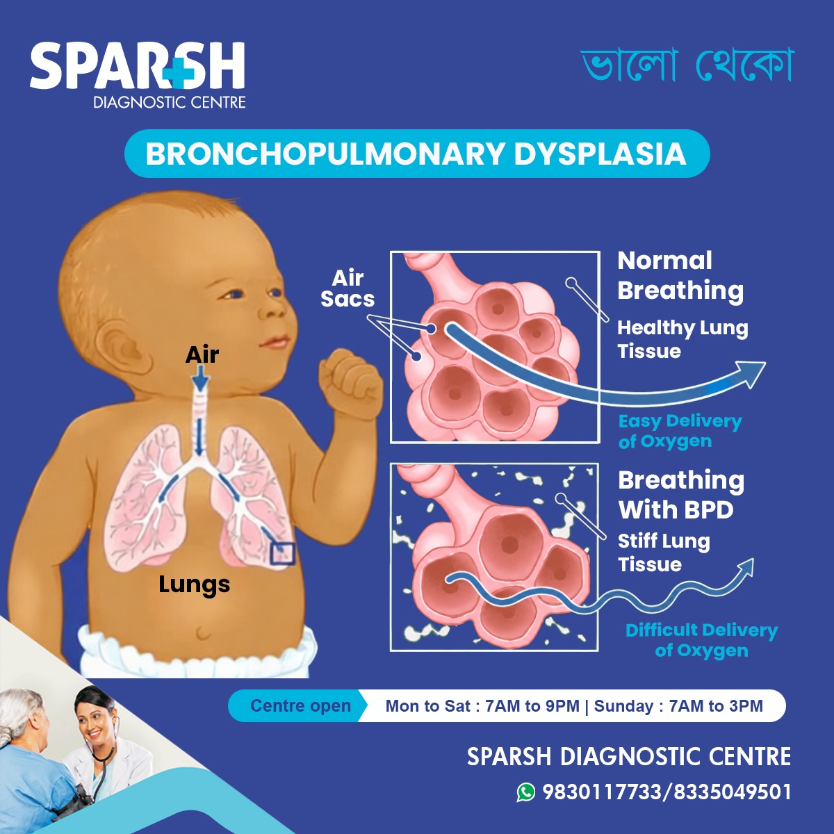 What Is Bronchopulmonary Dysplasia