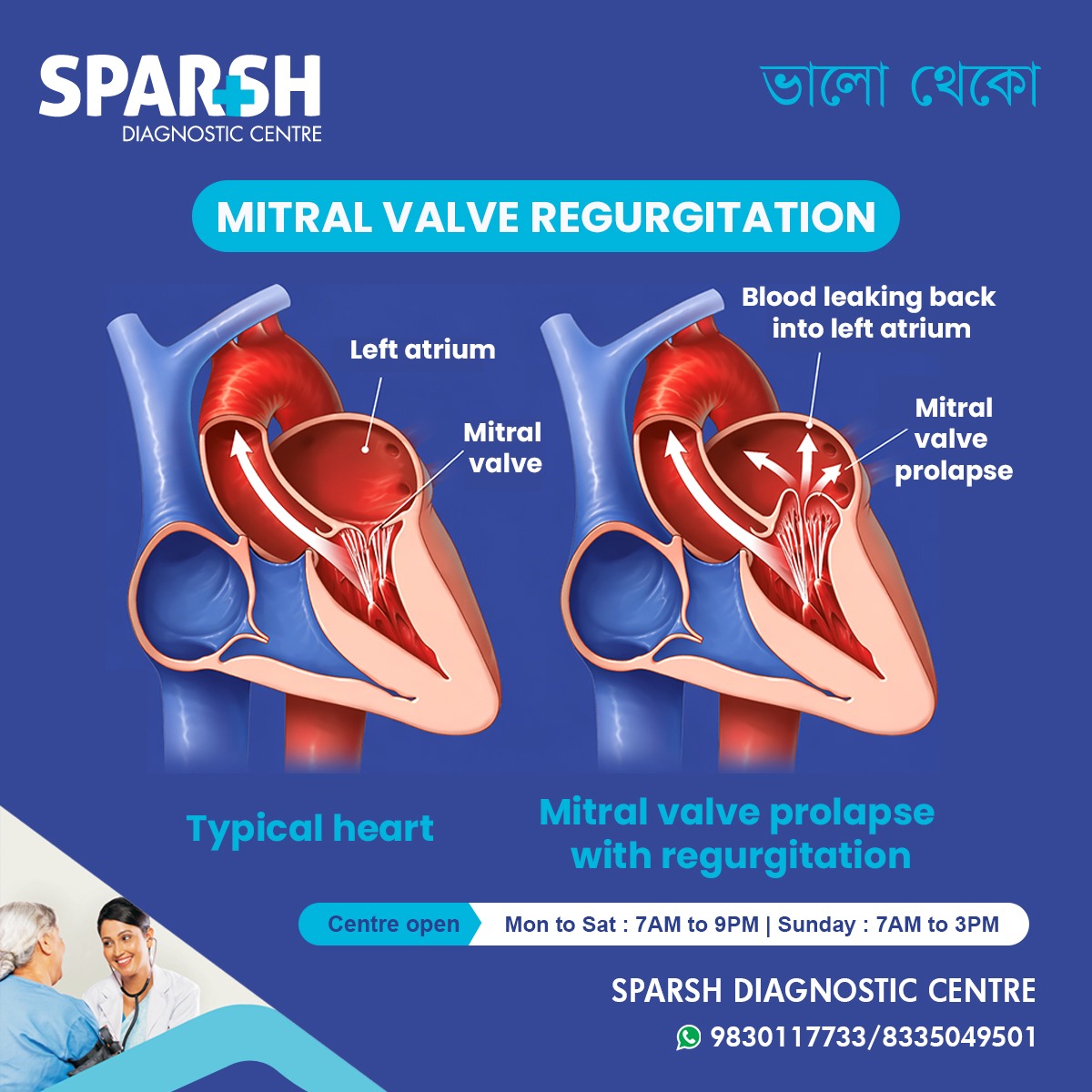 What Is Mitral Valve Regurgitation