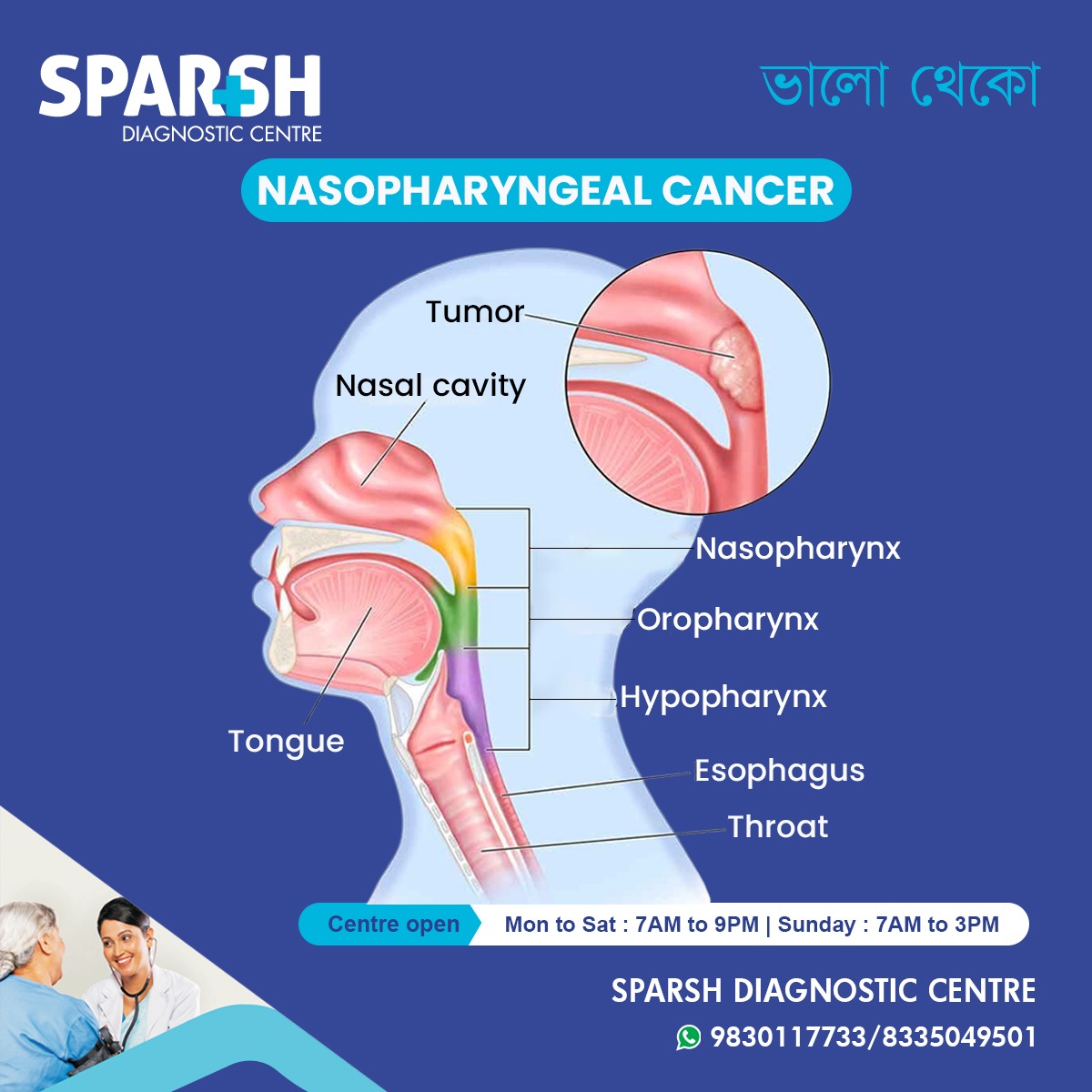 What Is Nasopharyngeal Cancer