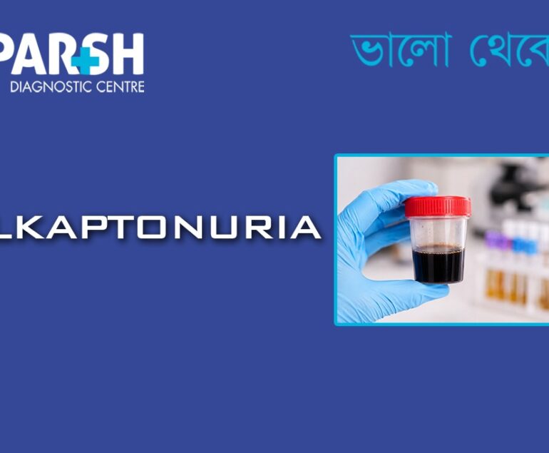 Alkaptonuria