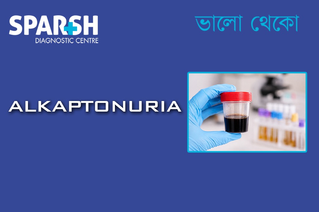 Alkaptonuria