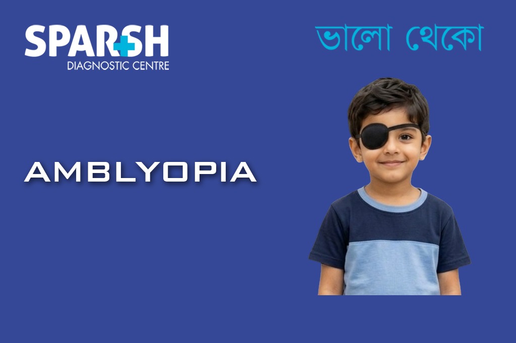 Amblyopia