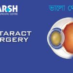 Cataract Surgery