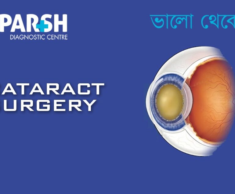 Cataract Surgery