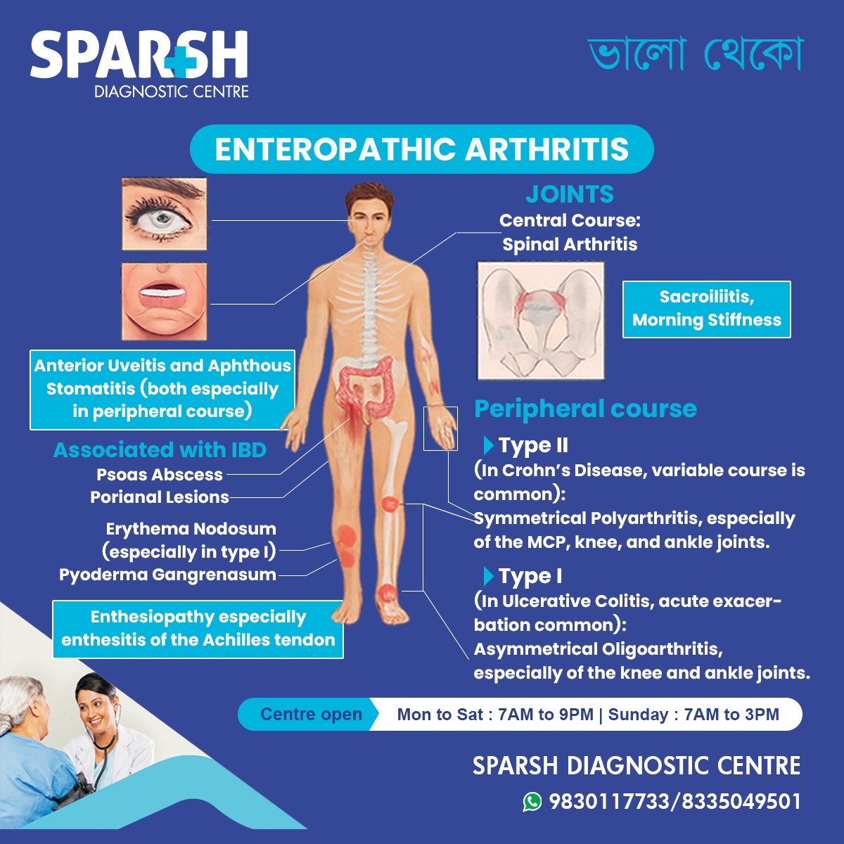 Enteropathic Arthritis