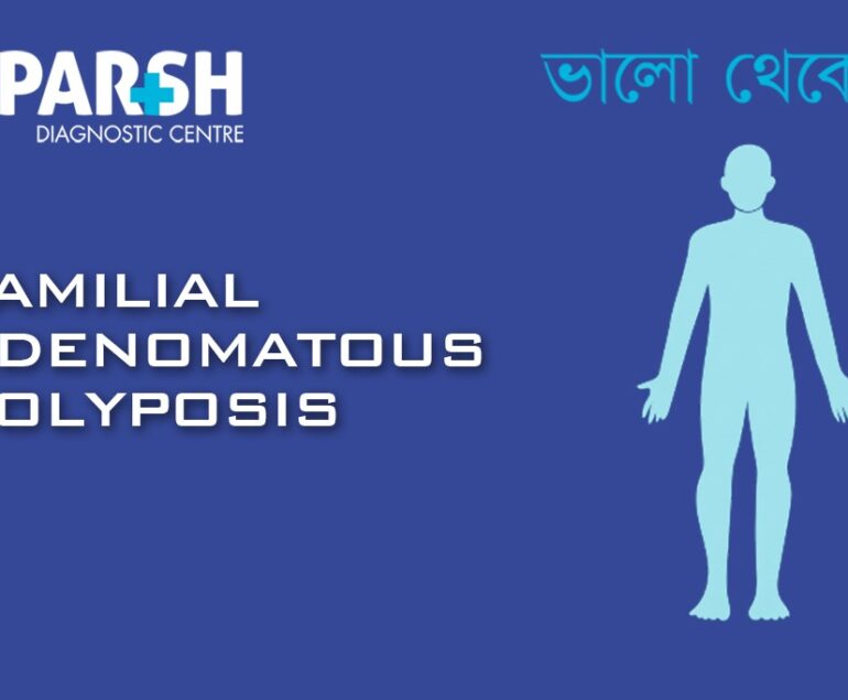 Familial Adenomatous Polyposis