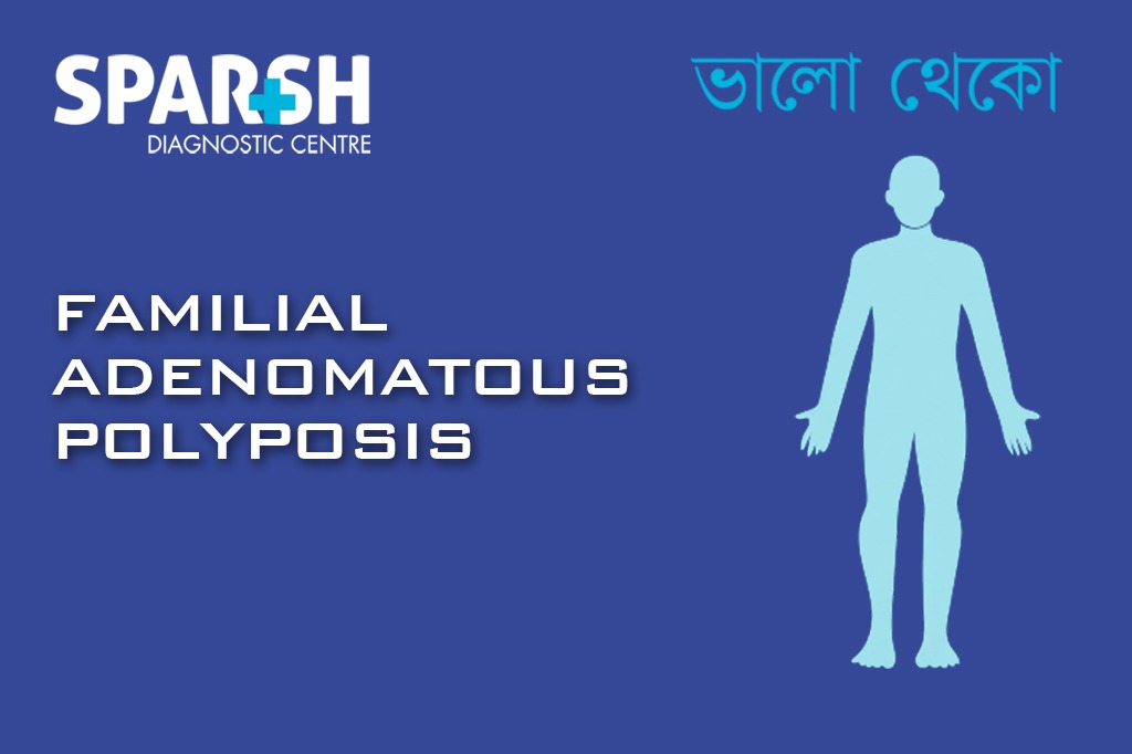 Familial Adenomatous Polyposis