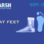 Flat Feet CP