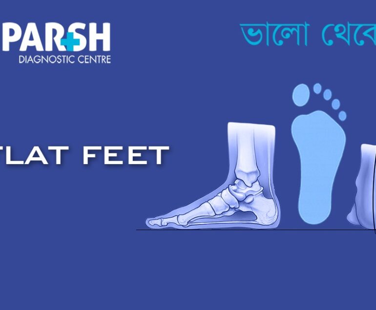 Flat Feet CP
