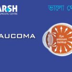 Glaucoma CP