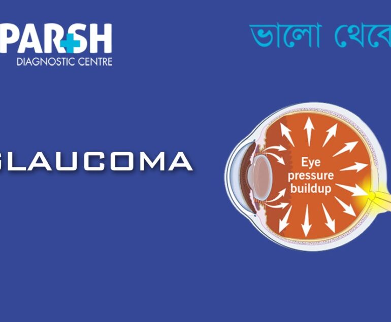 Glaucoma CP