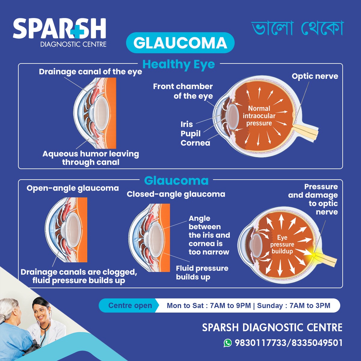 Glaucoma