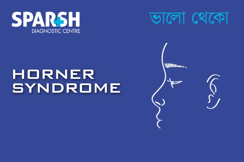 Horner Syndrome