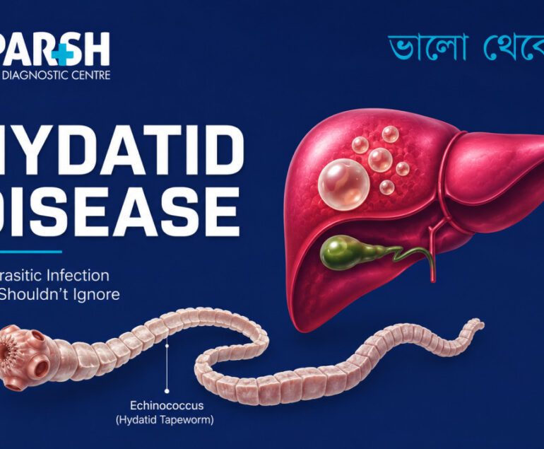 Hydatid Disease