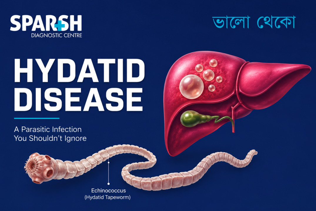 Hydatid Disease
