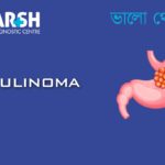 Insulinoma