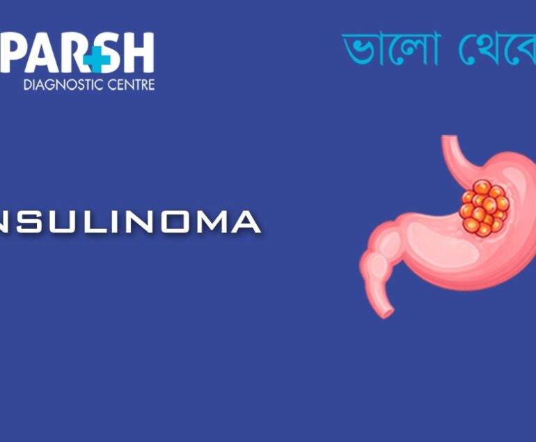 Insulinoma