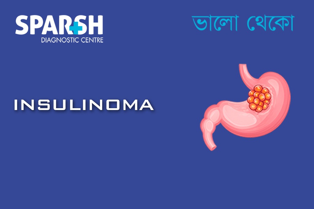 Insulinoma