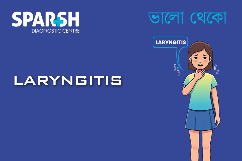 Laryngitis