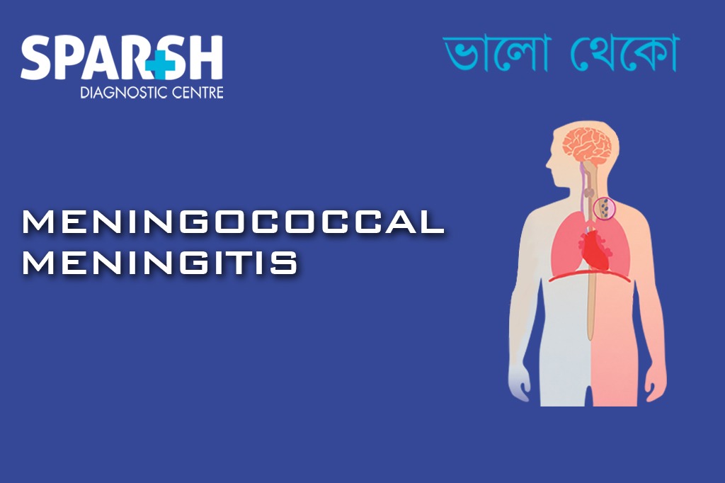 Meningococcal Meningitis CP