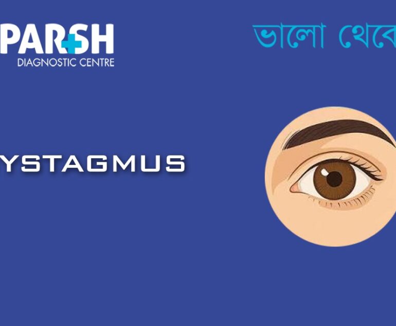 Nystagmus