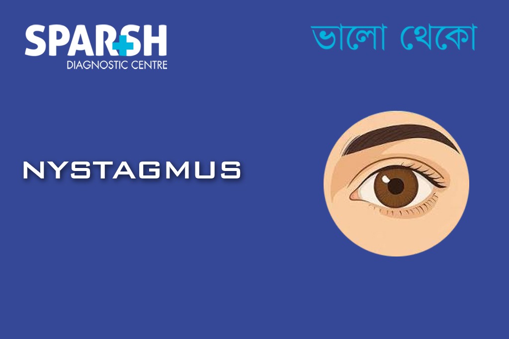 Nystagmus