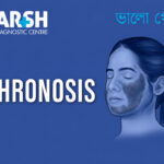 Ochronosis