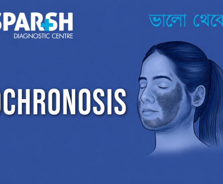 Ochronosis