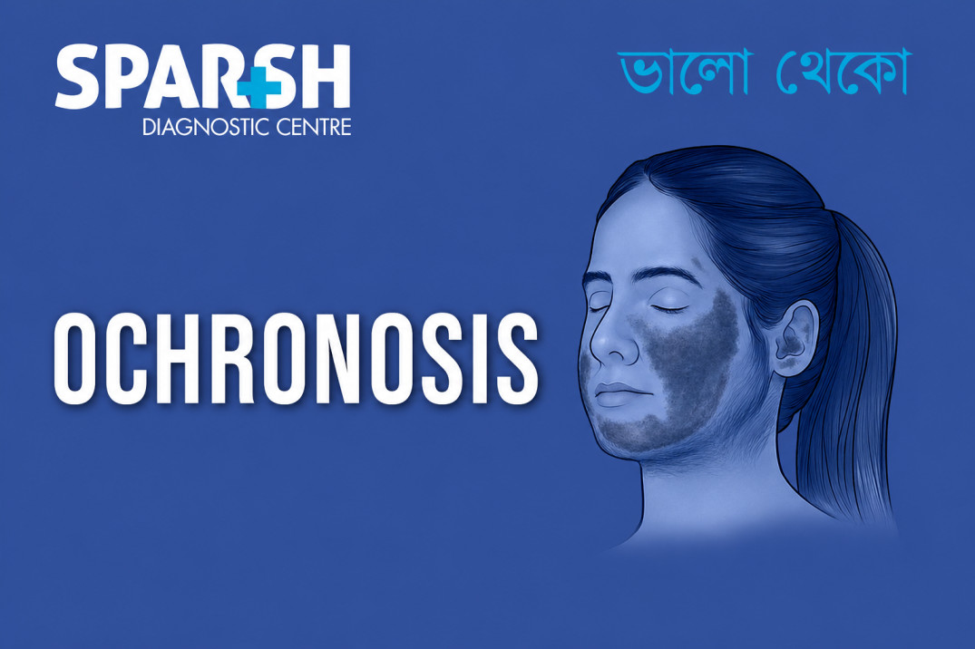 Ochronosis