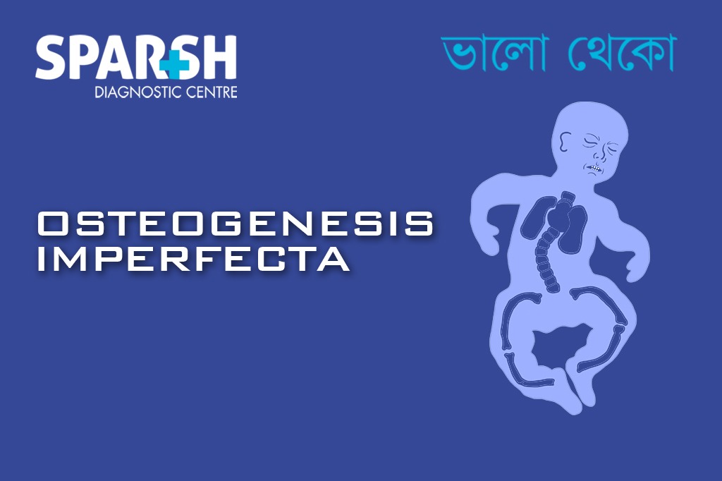 Osteogenesis Imperfecta