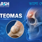 Osteomas