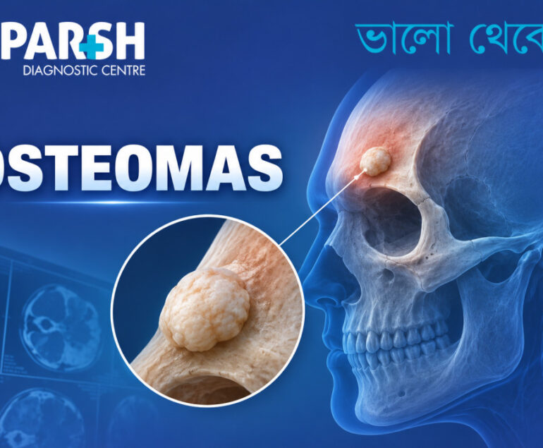 Osteomas
