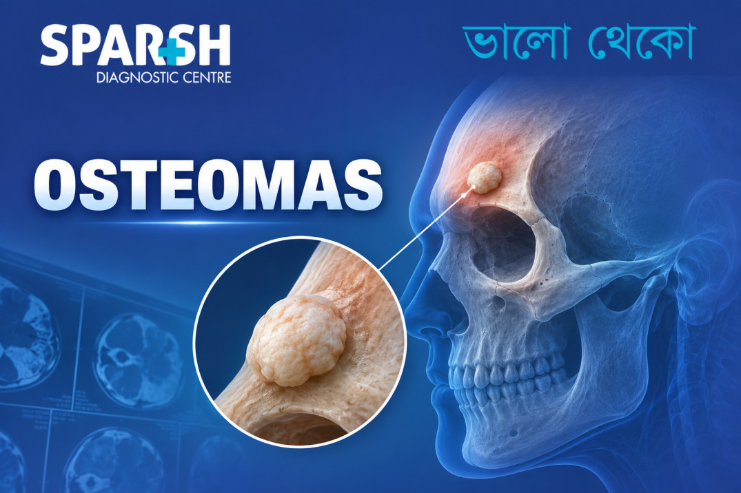 Osteomas