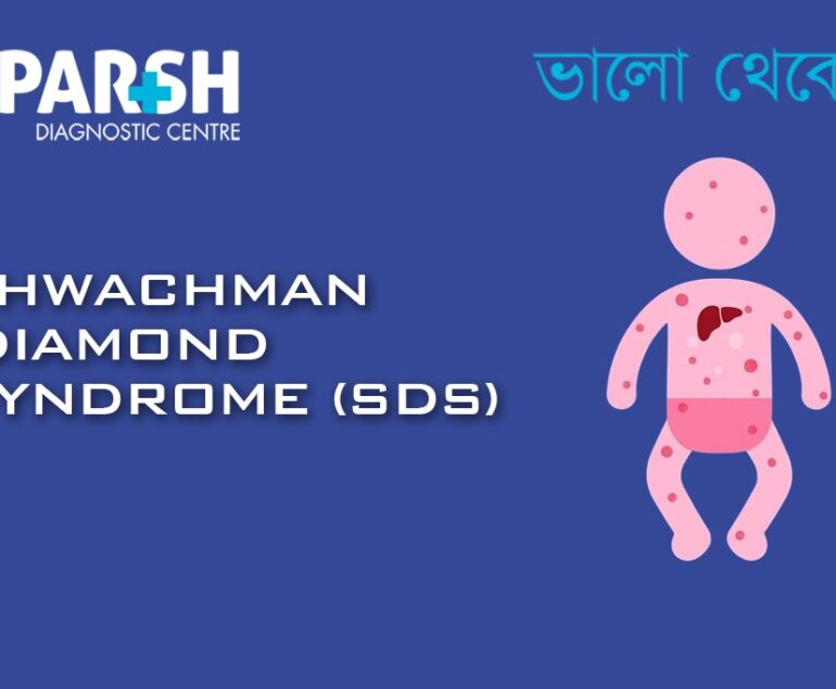 Swachman Diamond Syndrome SDS