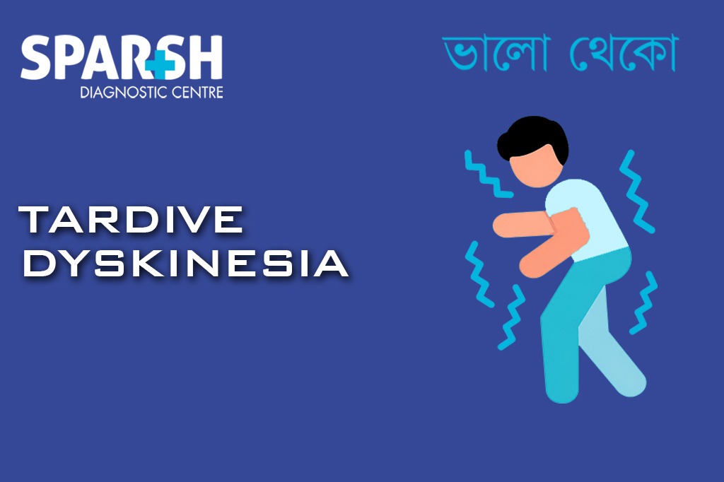 Tardive Dyskinesia