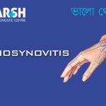 Tenosynovitis