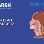 Throat Cancer CP