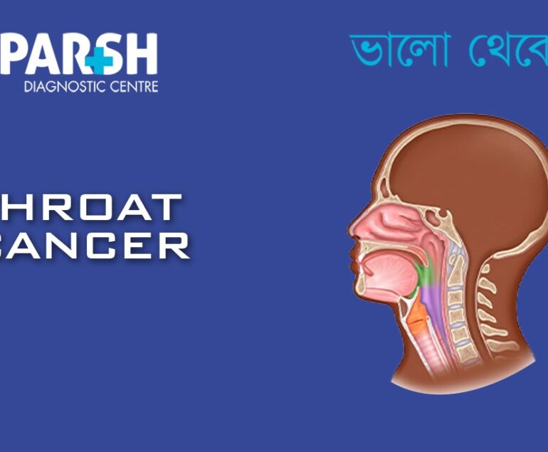 Throat Cancer CP