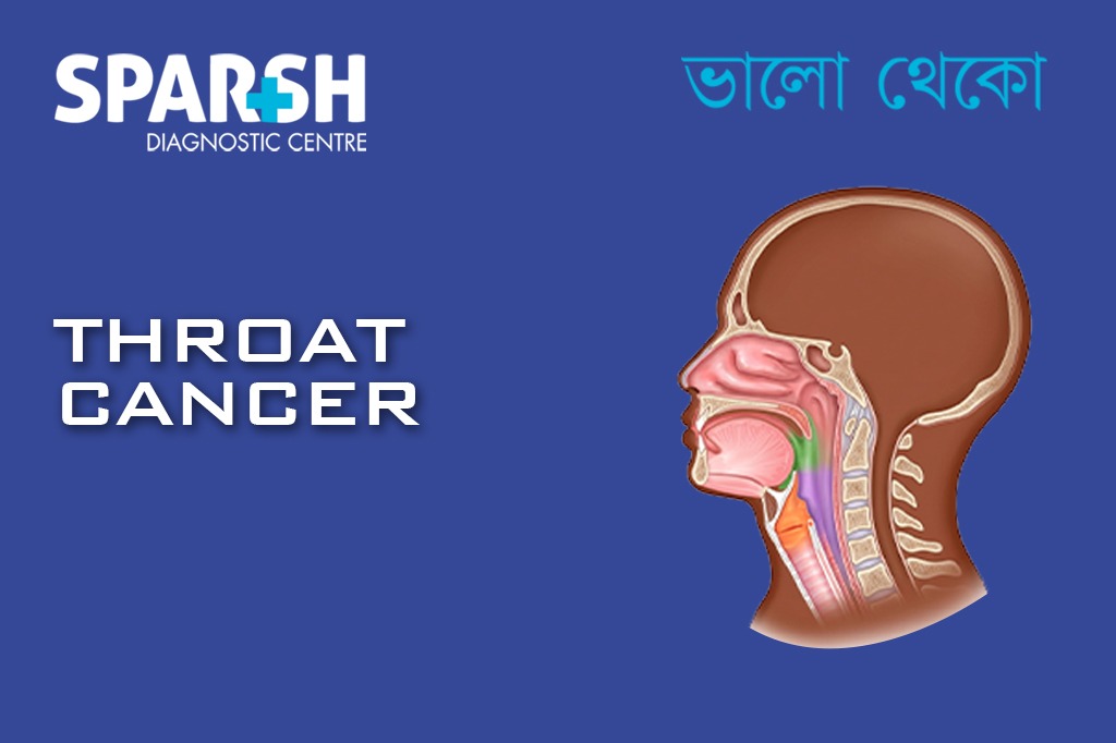 Throat Cancer CP