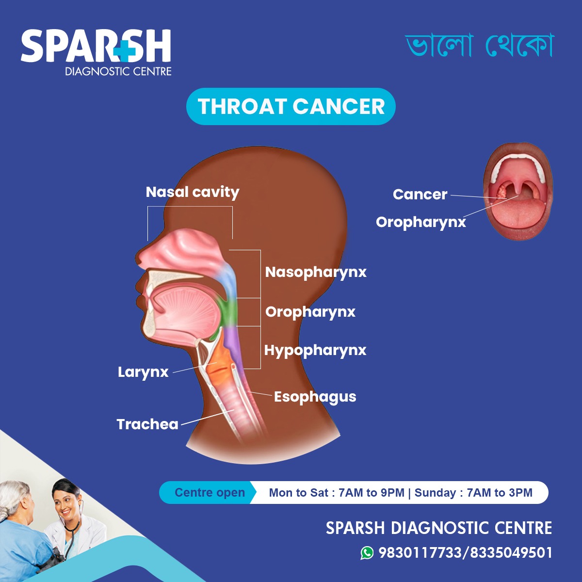 Throat Cancer